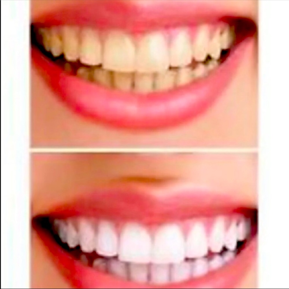 Whitening toothpaste